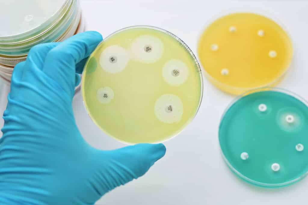 Scientist holds Petri dish in one hand